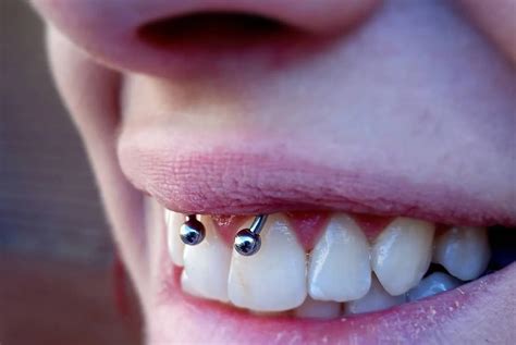 how long does the smiley piercing take to heal|The Truth About Smiley Piercings